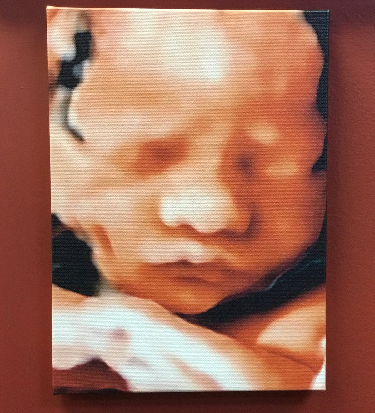 Canvas Ultrasound Photo