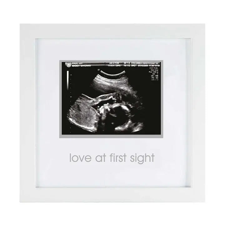 Love At First Sight Ultrasound Photo Frame