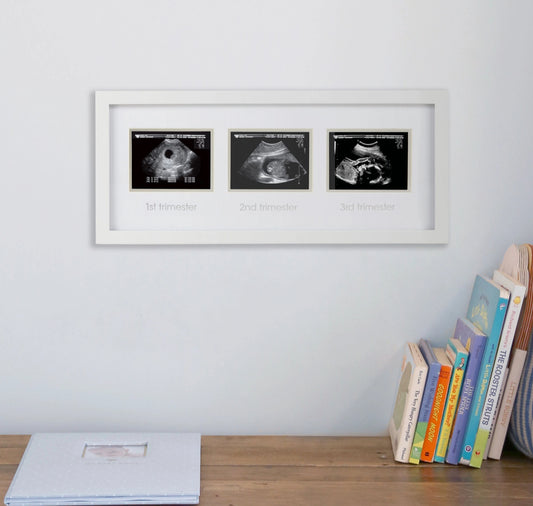 Trimester Sonogram Frame