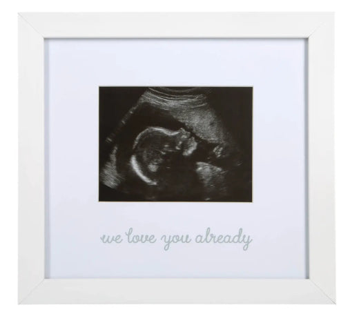 Ultrasound Frame