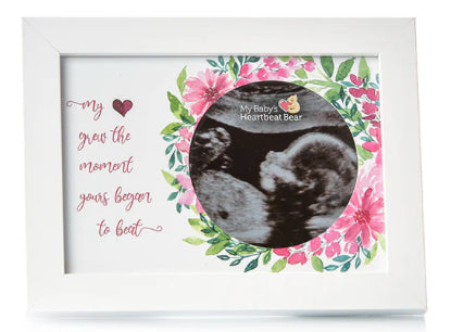 Ultrasound Frame