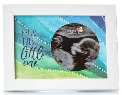 Ultrasound Frame