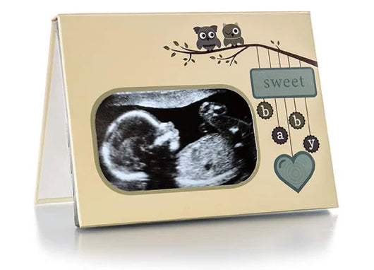 Ivory Recording Frame