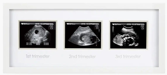 Trimester Sonogram Frame