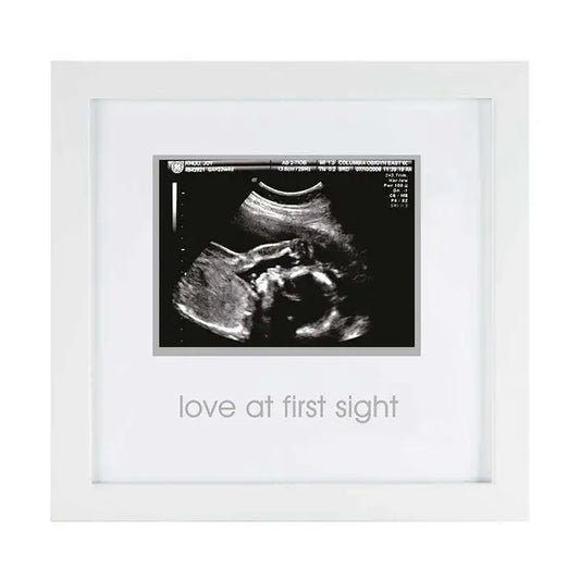 Love At First Sight Ultrasound Photo Frame